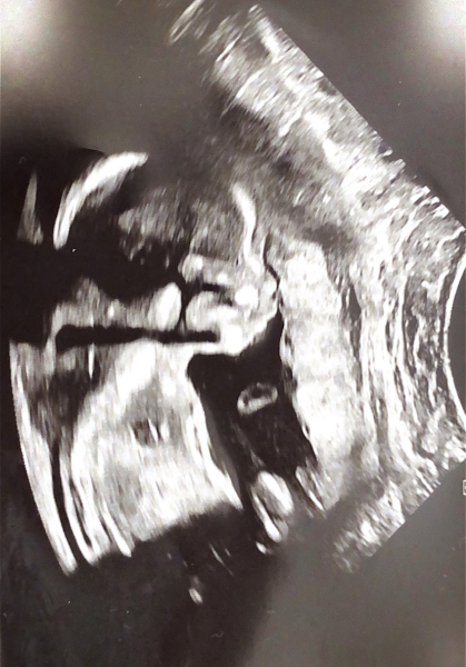 Gender guesses!