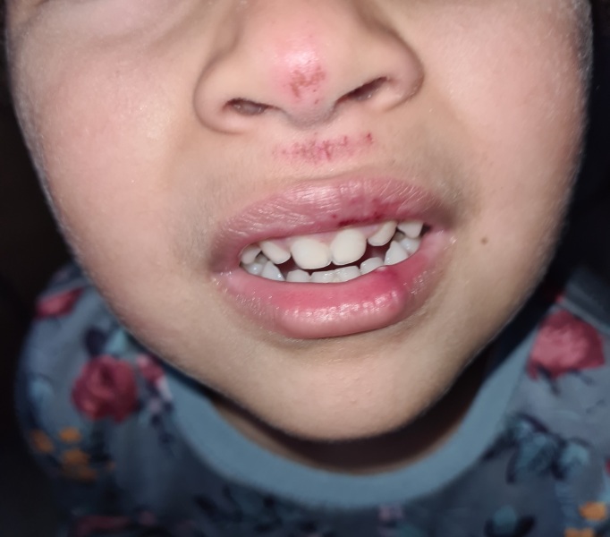 Is this a minor injury? (picture attached) 