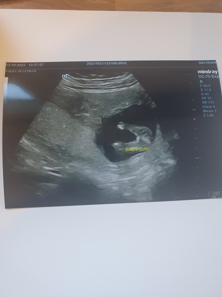 Due April 2023 💕 into the second trimester 🍂🎇