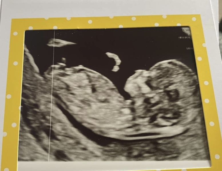 Babies due April 2023 Thread 6
