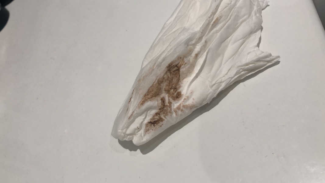 Did anybody have this brown discharge before finding out they were pregnant?  