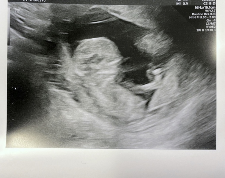 Babies due April 2023 Thread 6