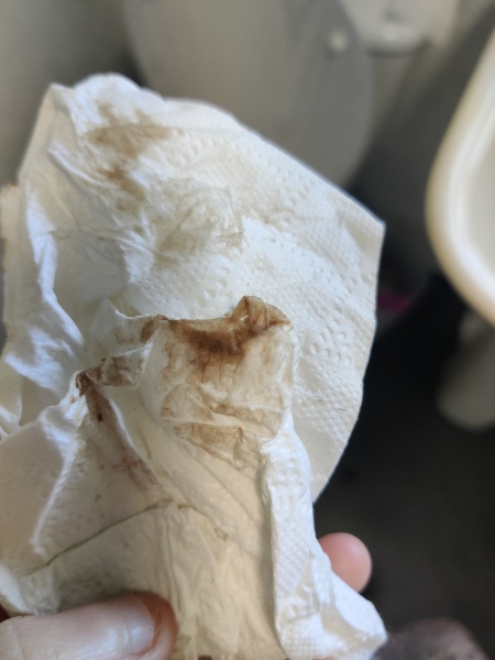 Is this anything to worry about. Includes tmi photo