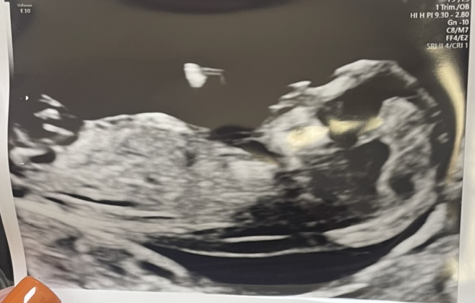 Babies due April 2023 Thread 6