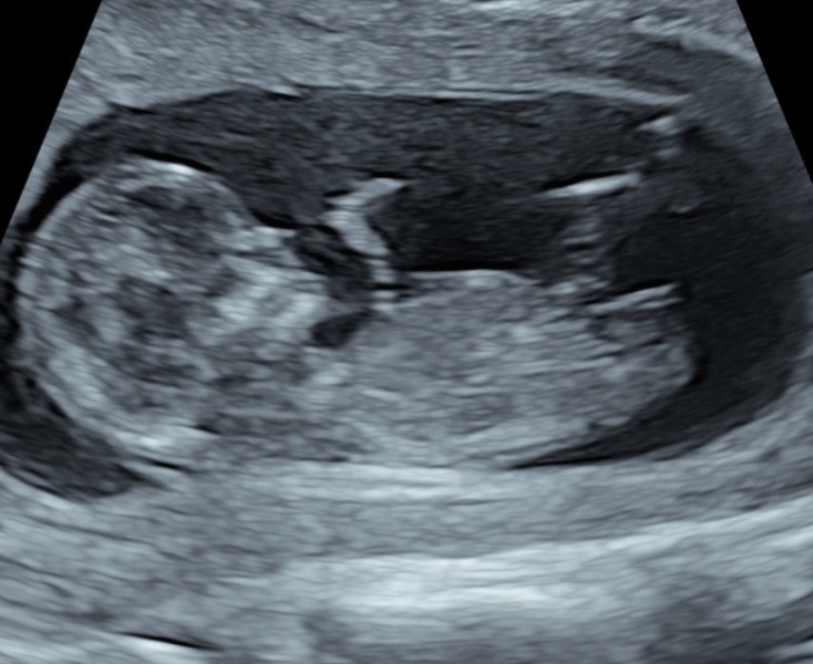 Due April 2023 💕 into the second trimester 🍂🎇