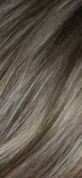 Hair loss from under active thyroid