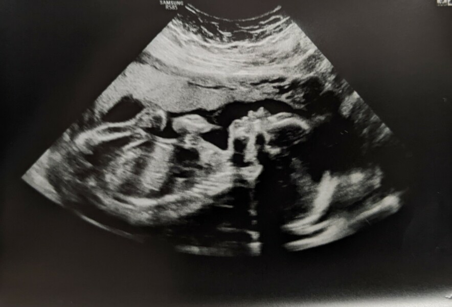 Due March 2023 - thread 4