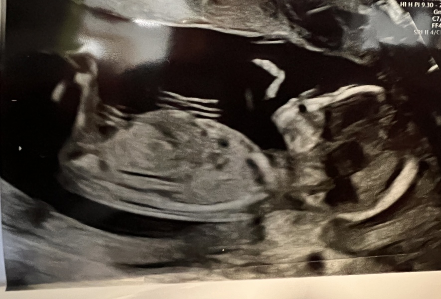 Due April 2023 💕 into the second trimester 🍂🎇