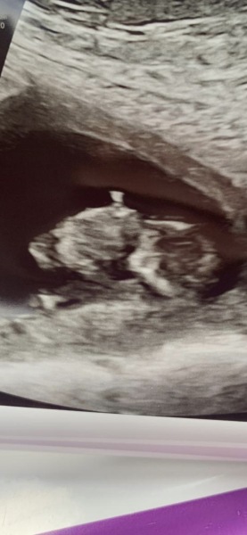 Babies due April 2023 Thread 6