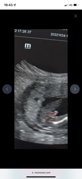 Girl or boy? Potty shot 