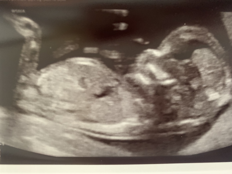 Babies due April 2023 Thread 6