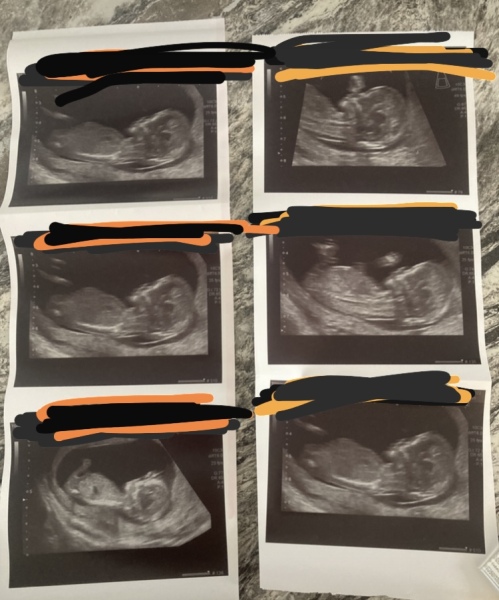 I’m so impatient any guesses welcome:))))