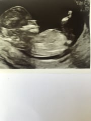 Babies due April 2023 Thread 6
