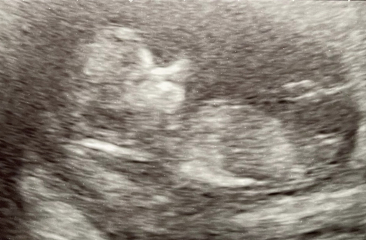 Babies due April 2023 Thread 6