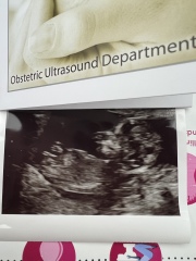 Due April 2023 💕 into the second trimester 🍂🎇