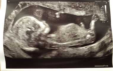 Boy or girl?
