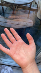 Coups this be hand, foot and mouth (photo)