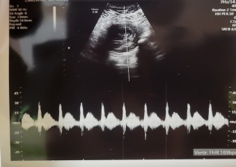 Babies due April 2023 Thread 6