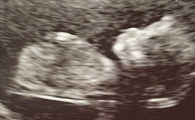 Babies due April 2023 Thread 6