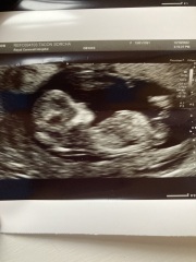 Gender guesses please :-)