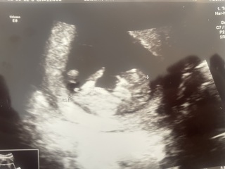 Nub theory for fun - 11 weeks