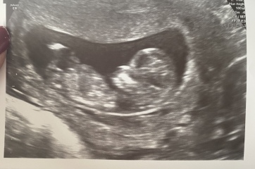 Babies due April 2023 Thread 6