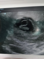 June 2023 Babies 🌞