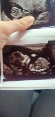 Babies due April 2023 Thread 6