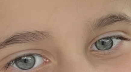 Eye Colour opinion