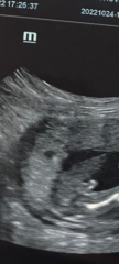 Girl or boy? Potty shot 