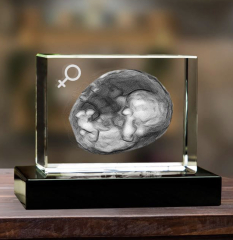 3D Printed Sonogram!