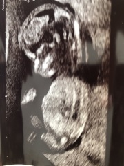 Gender guesses please 😊