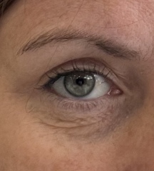 What to do with these wrinkly eyes 👀 