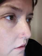 Looking for nose piercing advice- piercing bump/ keloid ?