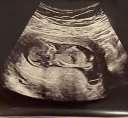 Babies due April 2023 Thread 6