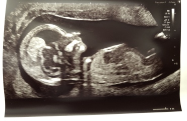 Boy or girl?