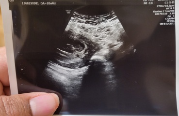 Babies due April 2023 Thread 6