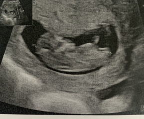 Babies due April 2023 Thread 6