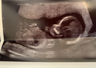 Nub guesses ♥️ will update!