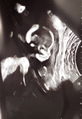 Gender guesses!