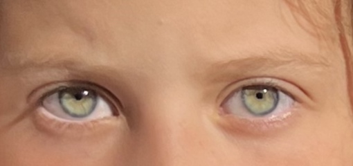 Eye Colour opinion