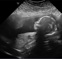 Due March 2023 - thread 4