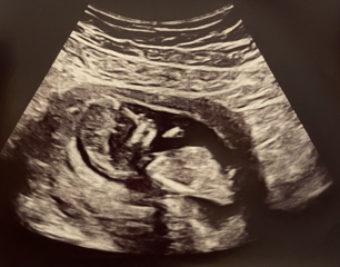 Babies due April 2023 Thread 6