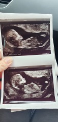 Babies due April 2023 Thread 6
