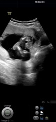 Boy or Girl ? 16 weeks potty shots