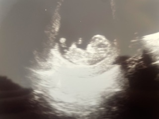 Nub theory for fun - 11 weeks