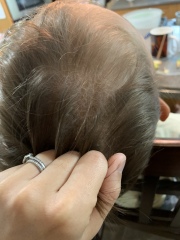Scalp help!