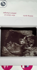 Due April 2023 💕 into the second trimester 🍂🎇