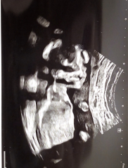 Gender guesses!