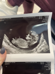 Babies due April 2023 Thread 6
